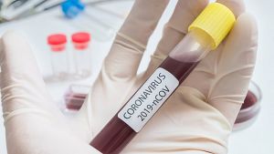 В Челябинской области за сутки прибавилось пять подтвержденных случаев заражения коронавирусом