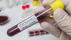 В Челябинской области вновь зафиксирован рекорд по зараженным коронавирусом за сутки