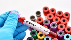 В Челябинской области зарегистрировано 6 982 случая заражения коронавирусом