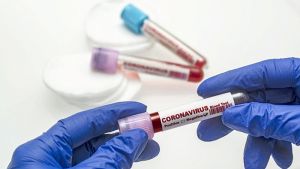 В Челябинской области прирост больных коронавирусом за сутки составил 270 человек