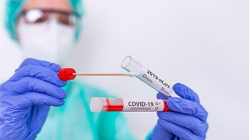 Суточный прирост заболевших коронавирусом в Челябинской области составил 107 жителей